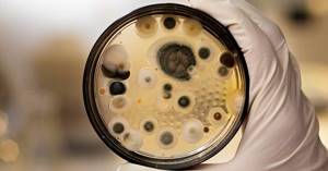 It is necessary to conduct a laboratory analysis of the fungus